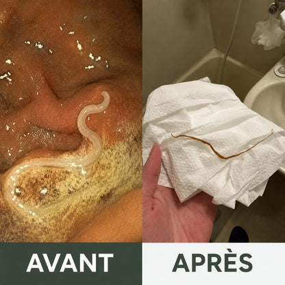 Huile de Ricin Bio — Dégonfle le Ventre Pendant que Vous Dormez